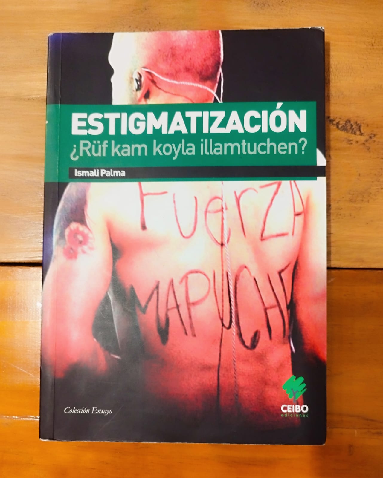 Estigmatización